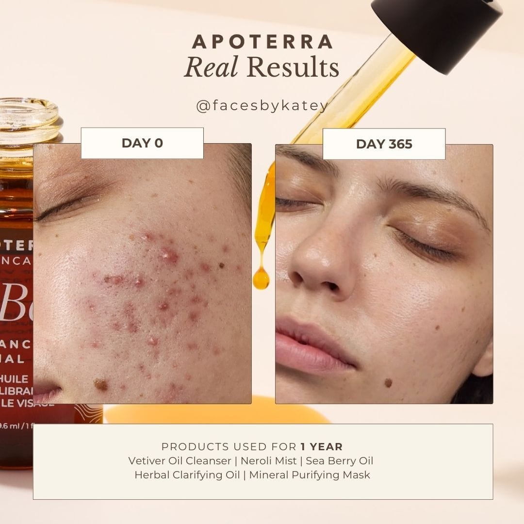 Sea Berry Balancing Facial Oil